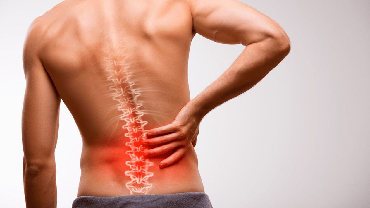 Lumbar sciatica