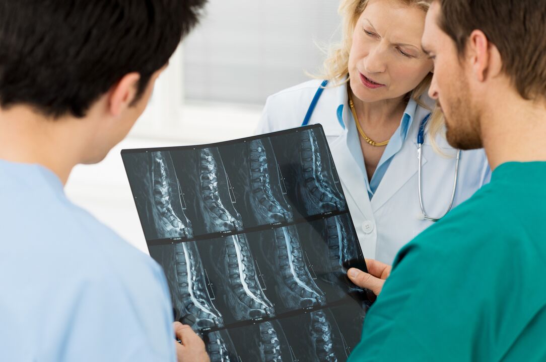 Diagnosis of osteochondrosis