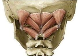 The deep muscles on the neck are fixed in the wrong position