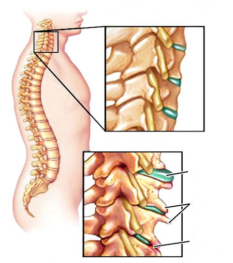 What has the bone cartilage become